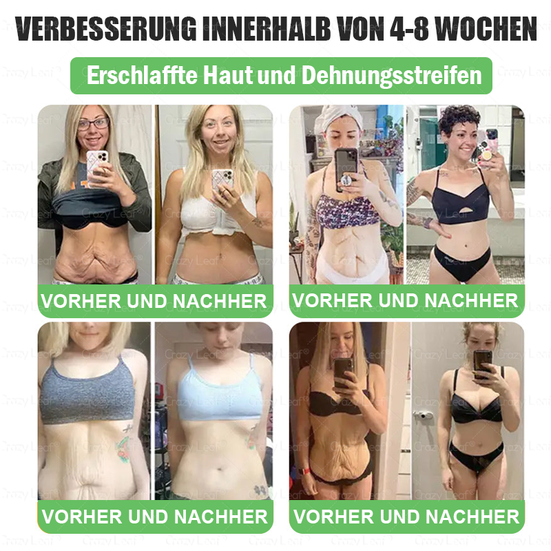 ✨Klinisch bewiesen | Offizieller Shop | 𝐂𝒓𝓪𝙯𝙮𝐋𝑒𝑎𝐟® 𝚂𝖬𝐺𝘛-𝘎𝐿𝙋-1 Orallösung gegen Übergewicht, Bluthochdruck, Blutzucker- & Fettleberprobleme, Gelenkschmerzen, Müdigkeit, Energiemangel & schlaffe Haut – für mehr Gesundheit & Vitalität.