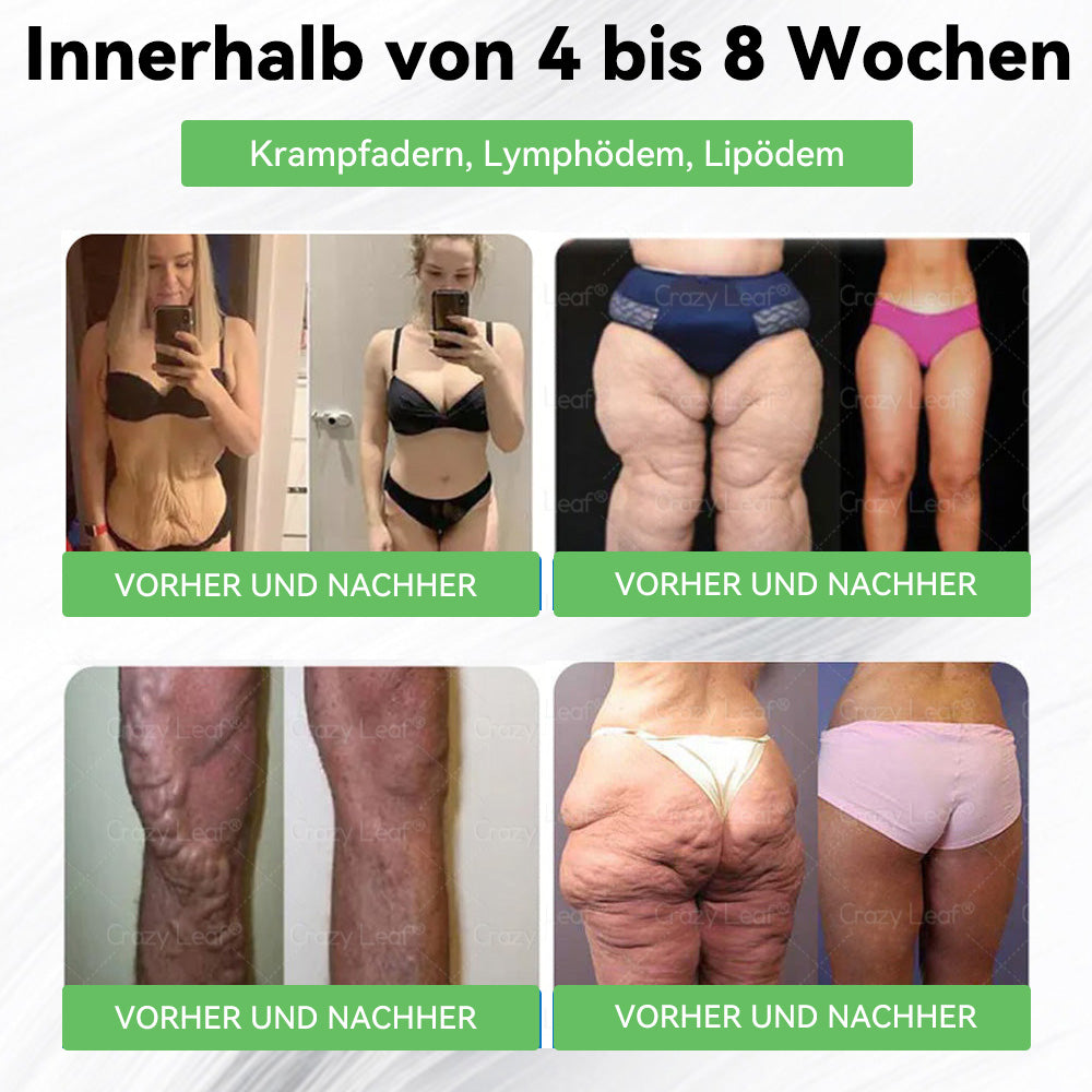 ✨Klinisch bewiesen | Offizieller Shop | 𝐂𝒓𝓪𝙯𝙮𝐋𝑒𝑎𝐟® 𝚂𝖬𝐺𝘛-𝘎𝐿𝙋-1 Orallösung gegen Übergewicht, Bluthochdruck, Blutzucker- & Fettleberprobleme, Gelenkschmerzen, Müdigkeit, Energiemangel & schlaffe Haut – für mehr Gesundheit & Vitalität.