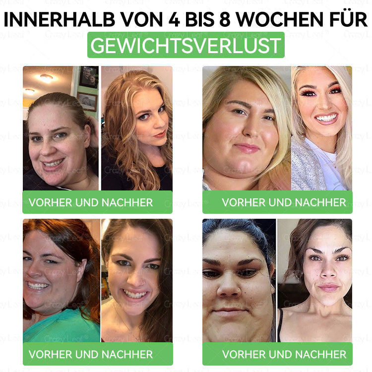 ✨Klinisch bewiesen | Offizieller Shop | 𝐂𝒓𝓪𝙯𝙮𝐋𝑒𝑎𝐟® 𝚂𝖬𝐺𝘛-𝘎𝐿𝙋-1 Orallösung gegen Übergewicht, Bluthochdruck, Blutzucker- & Fettleberprobleme, Gelenkschmerzen, Müdigkeit, Energiemangel & schlaffe Haut – für mehr Gesundheit & Vitalität.