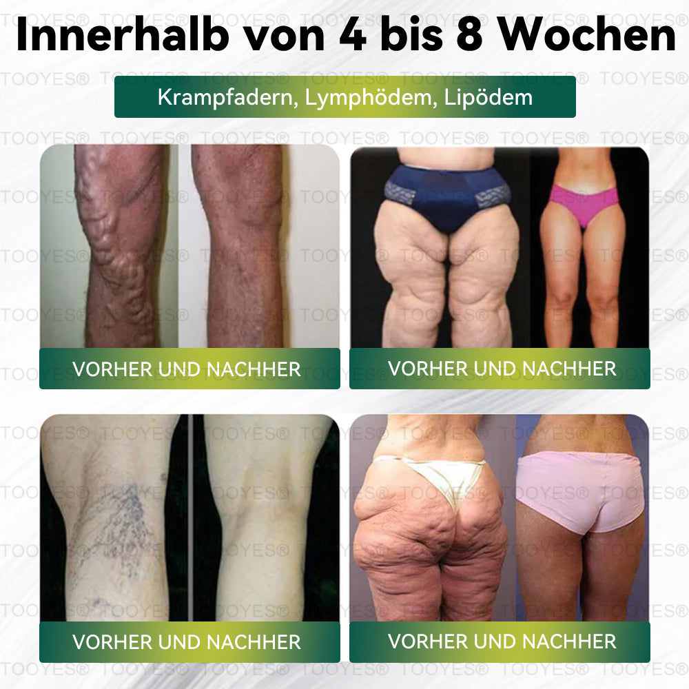 ✨🎁🎁𝑇𝑂𝑂𝑌𝐸𝑆® 🎁 Nur noch 5 Packungen übrig! Wir bieten dir zusätzlich 30 % Rabatt! Bring dich fit und gesund. Verpasse es jetzt – bis nächstes Jahr gibt es keine weitere Chance.