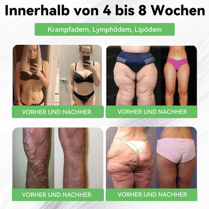 ✨Klinisch bewiesen | Offizieller Shop | 𝐂𝒓𝓪𝙯𝙮𝐋𝑒𝑎𝐟® 𝚂𝖬𝐺𝘛-𝘎𝐿𝙋-1 Orallösung gegen Übergewicht, Bluthochdruck, Blutzucker- & Fettleberprobleme, Gelenkschmerzen, Müdigkeit, Energiemangel & schlaffe Haut – für mehr Gesundheit & Vitalität.